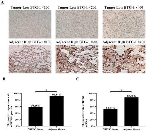 Btg Protein And Btg Mrna Expression In Nsclc Tissues And Adjacent