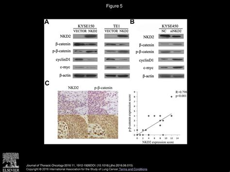 Silencing NKD2 By Promoter Region Hypermethylation Promotes Esophageal