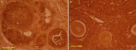 Tunel Stained Slides Of Transplanted Ovarian Tissue With And Without