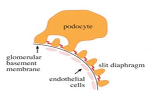 podocyturia slowitdownckd