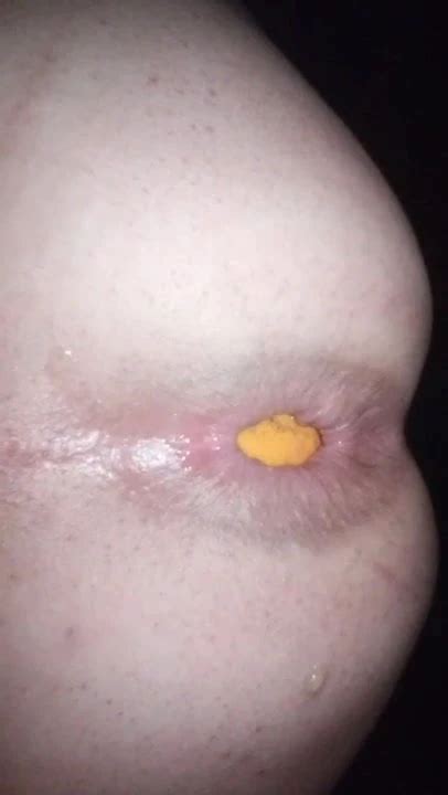 Boipussy Gay Man Porn XHamster