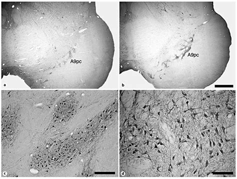 photomicrographs   clustered organization   pars compacta