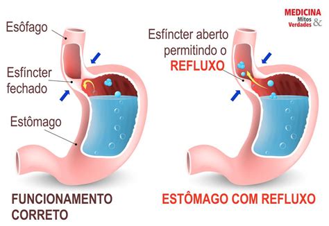 Ph Do Estômago Humano - 8