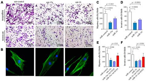 MicroRNA 15a 16 SOX5 Axis Promotes Migration Invasion And Inflammatory