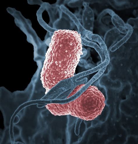 Klebsiella Pneumoniae Pa Eczka Zapalenia P Uc Przyczyny Objawy