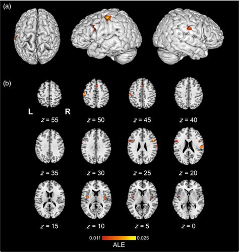 The Location Of Significant Activation Likelihood Estimation Ale