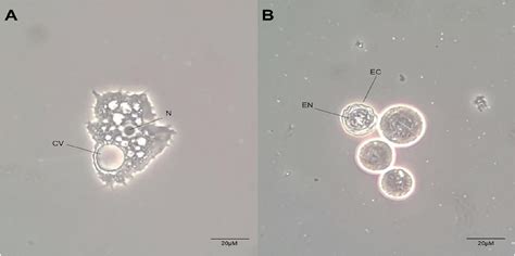 Diagnosis And Treatment Of Acanthamoeba Keratitis A Scoping Review Demonstrating Unfavorable