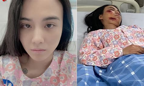 Hot girl Linh Miu chính thức lên tiếng về ảnh nằm viện không xoa dịu dân mạng mà như thêm dầu