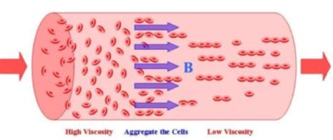 The Importance of Knowing Your Blood Viscosity! - Medical Detective MD