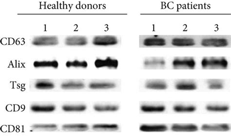 Characterization of exosomes by tracking analysis (NTA) and Western ... 