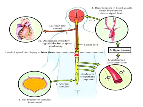 Critical Care Neuro Flashcards Quizlet