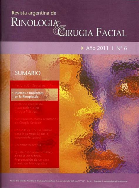 PDF Injertos E Implantes En Rinoplastia Drmoina Ar E Implantes