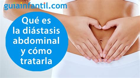 Qué es la diástasis abdominal Cómo prevenirla y cómo aprender a