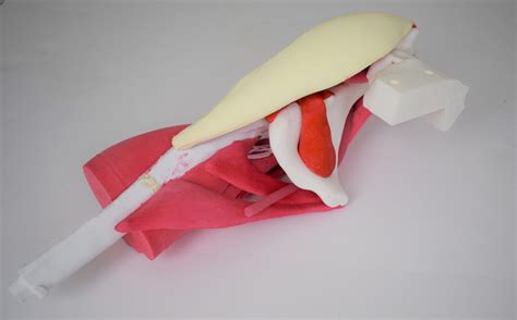 Stryker Comprehensive Hip – Uncasted – SurgiSTUD