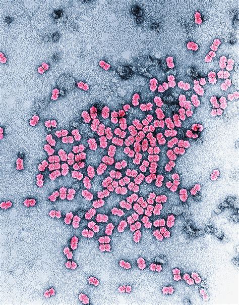 Maize Streak Virus Tem Stock Image M0800071 Science Photo Library