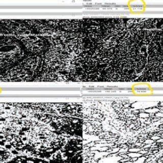 Morphometric analysis showing the morphometric analysis with an... | Download Scientific Diagram