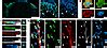 JCI Insight ICAM1 Neutrophils Promote Chronic Inflammation Via