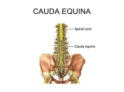 Medula Espinhal Cauda Equina - Cone Medular E Cauda Equina - FDPLEARN