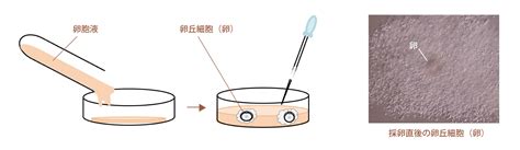 検卵・精子調整｜高崎artクリニック：不妊治療 体外受精 高度生殖医療