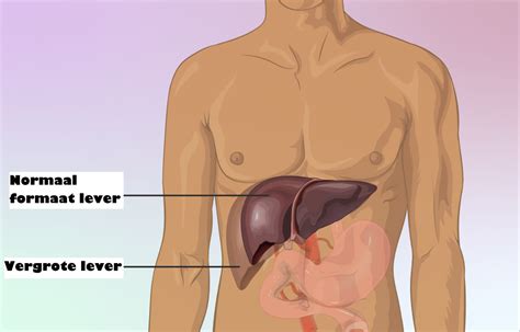 Pijn Rechts Onder De Ribben Door De Lever Mens Gezondheid