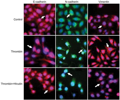 Thrombin Induces Alteration In Morphology Of Skov3 Cells Skov3 Cells