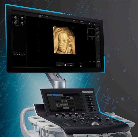 ge versana premiere ultrasound  ob  gyn medical examinations
