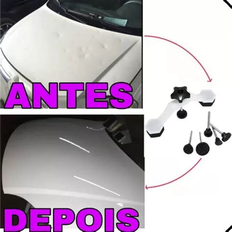 Removedor Amassados Automotivo Remove Qualquer Amassado Frete Gr Tis