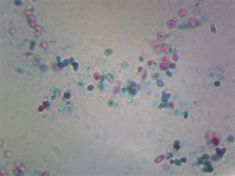 Saccharomyces Cerevisiae, Budding Cells, w.m. - Nebraska Scientific