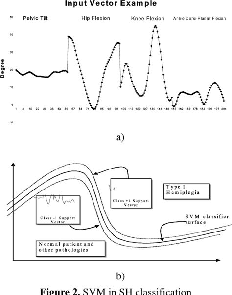 Figure 2 from SPASTIC HEMIPLEGIA GAIT CHARACTERIZATION USING SUPPORT ...