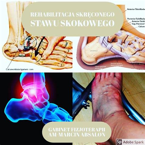 Odcinek12 rehabilitacja skręconego stawu skokowego Fizjoterapia