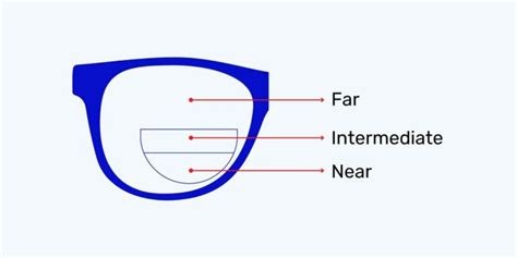 What Are Trifocal Lenses?