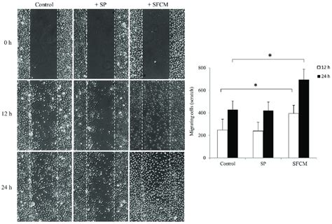 Wound Healing Scratch Assay Was Made On 24 H Growth Factor Starved Download Scientific Diagram