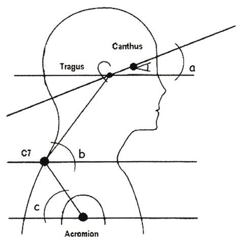 SciELO Brasil Cervical And Shoulder Postural Assessment Of