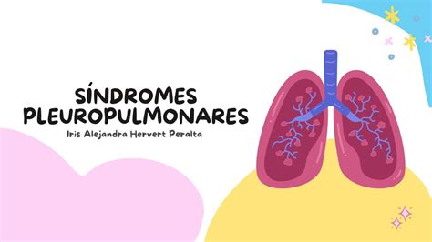 Sin Pleuropulmonares Pdf Pdf Iris UDocz