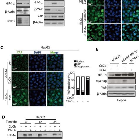 Hypoxia Induced Yap Nuclear Translocation And Accumulation In Hcc