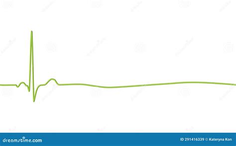 ECG in Asystole, 3D Illustration Stock Illustration - Illustration of ...