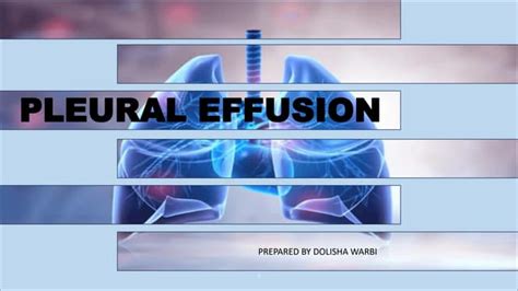 Pleural Effusion Types And Management Pdf