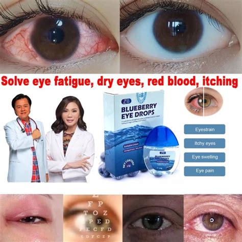 Original Blueberries Eye Drops For Clear Vision Dry Eyes Congestion