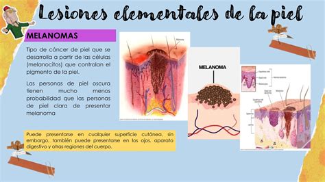 Lesiones Elementales De La Piel Pptx