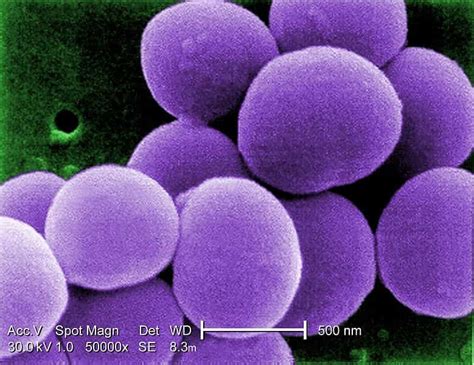 D Finition Staphylocoque Dor Staphylococcus Aureus Futura Sant