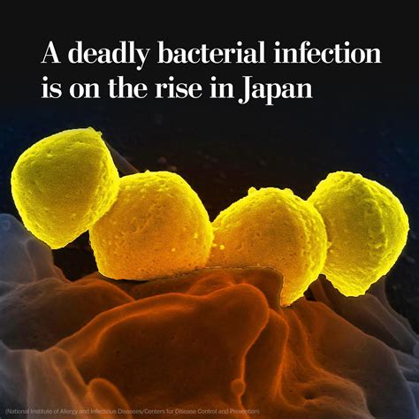 Bacterial Infection Bacterial Infection(MRSA Infection) | Methicillin