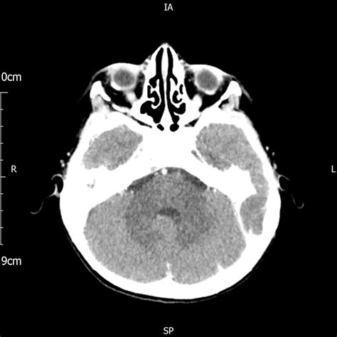 Image Radiopaedia Org