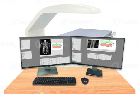 Close up Bone density whole body and wrist ,The X-ray department of hospital used for diagnose ...