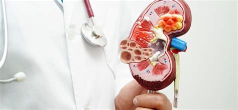 Камни в почках: диагностика и методы лечения