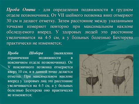 Суставной синдром - презентация онлайн