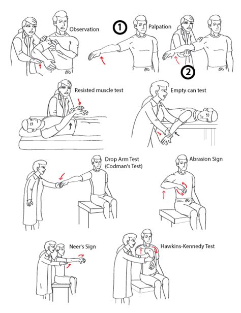 Diagnosing Supraspinatus Tears