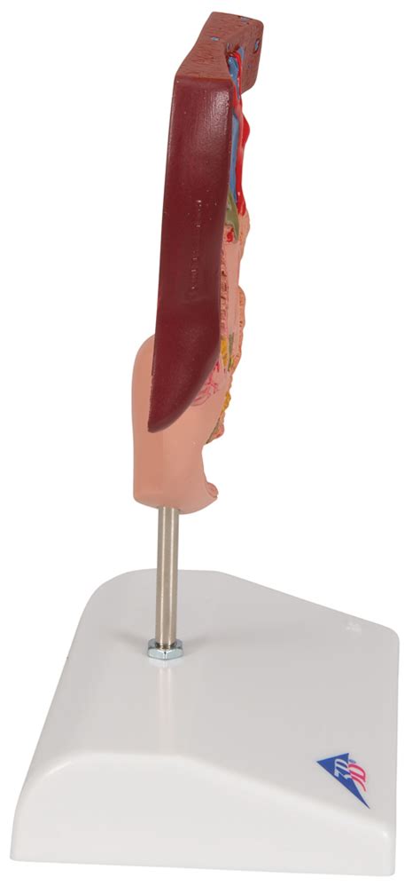 Modelo De Cálculo Biliar Medical Factory