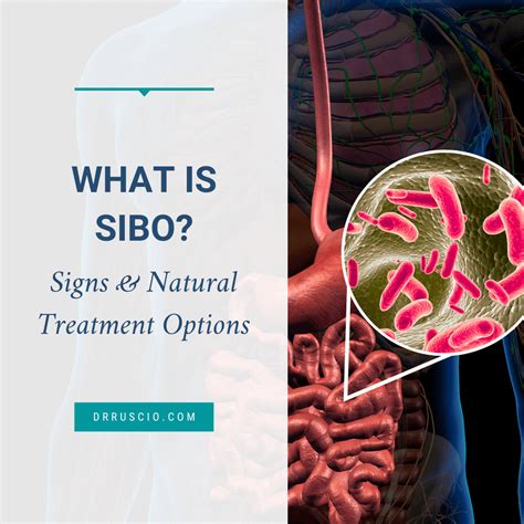 Allison Siebecker Interview SIBO