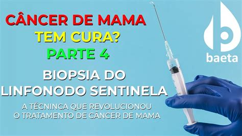 BIOPSIA DO LINFONODO SENTINELA A TÉCNICA QUE REVOLUCIONOU O