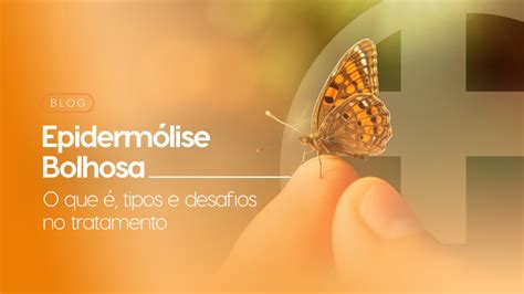 O Que É Epidermólise Bolhosa